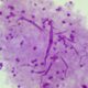 nhs-offers-world-first-vaccine-to-combat-rise-in-gonorrhoea
