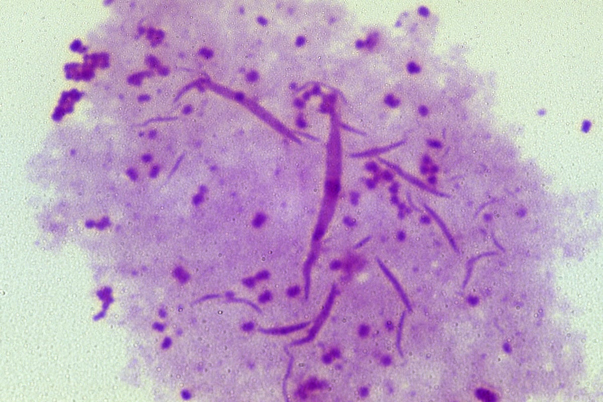nhs-offers-world-first-vaccine-to-combat-rise-in-gonorrhoea